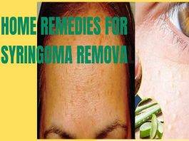 home-remedies-for-syringoma-removal