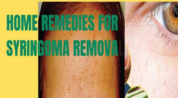 home-remedies-for-syringoma-removal