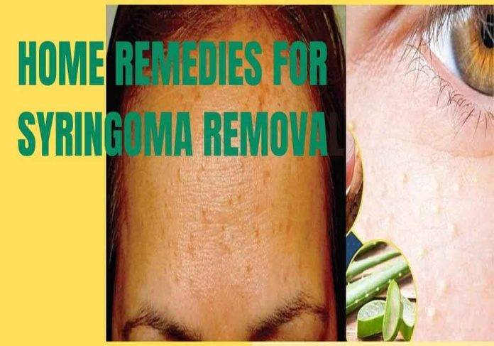 home-remedies-for-syringoma-removal